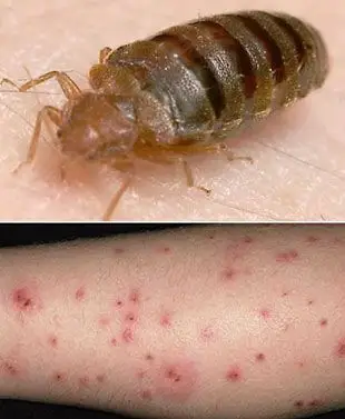 简介:臭虫即床虱,雌性臭虫一生可以产卵200至500个,虫卵经过5次蜕皮就