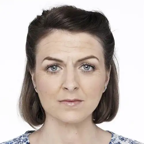 看电脑容易出现抬头纹.(图片取自太阳报)