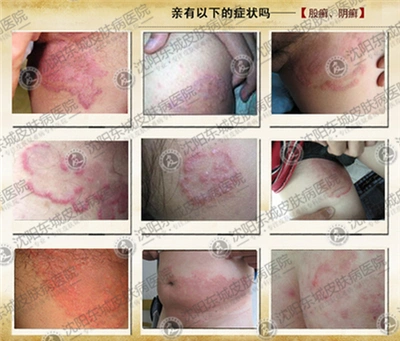 搔着痒处「搔着痒处的时候少」