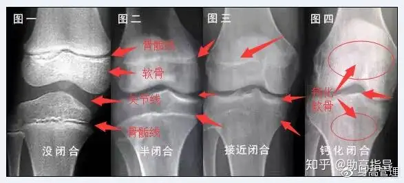 现代医学已证明:人的骨骼及脑垂体在20-28岁之间是处于半闭合半休眠