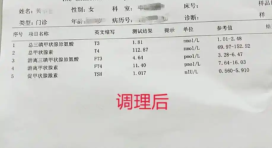 真实案例:甲亢患者爱生气,这样调理指标恢复正常_甲状腺_中药_症状