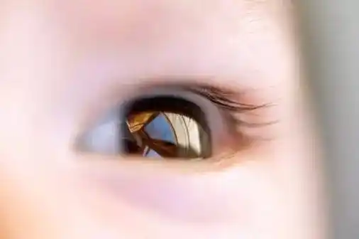 (近视弱视散光青光眼白内障视力康复养护加盟国科惠眼眼健康)