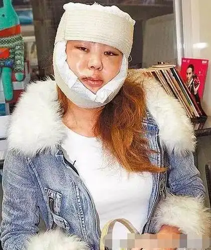 身价过10亿大方承认整容,林心如是其干女儿