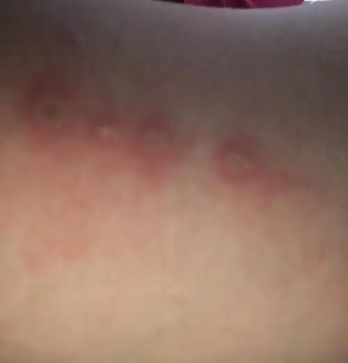 追问 我才15岁 追答 哈,那可能是蜘蛛撒尿 追问 .