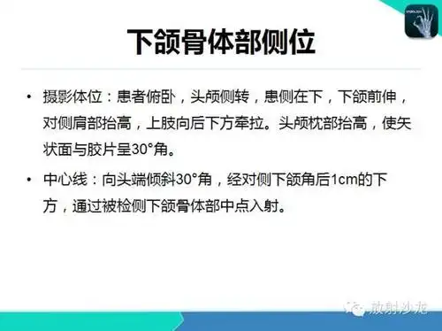 不常用投照体位