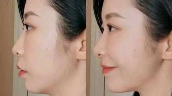 嘴凸下巴后缩的侧脸拍照技巧超级简单一看就会