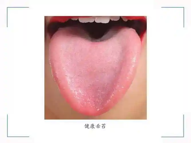 舌象知识点分享