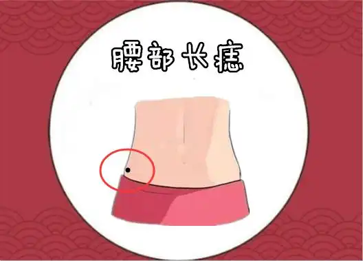 若是一个的腰部的位置处长有吉痣,则往往会被"腰缠万贯"的说法,以腰部