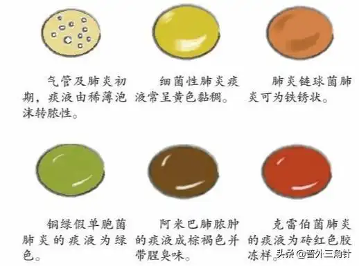 听人说,吐黄痰轻,黑痰重,吐了白痰要了命是啥意思?