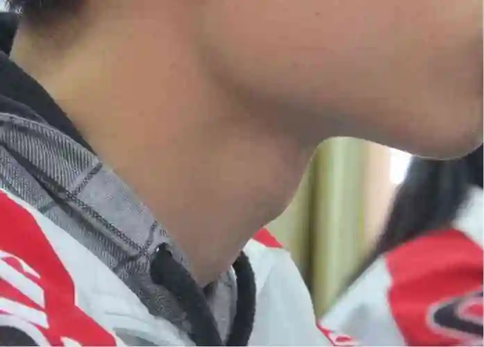 猛涨期喉结变化