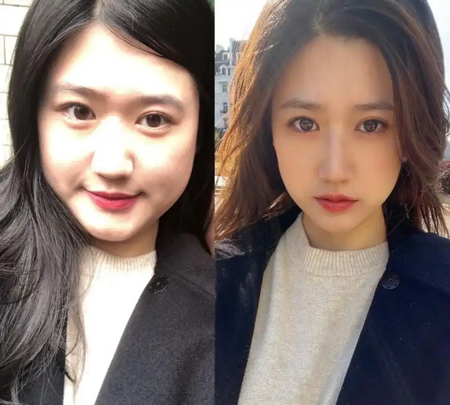 甲减好了,这是甲减前后对比 同一个人,同一套衣服,同一个美颜相机