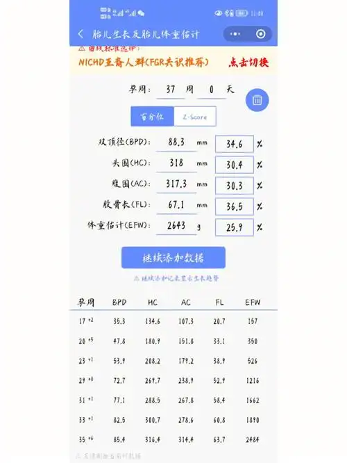 预产期113037周羊水指数偏低