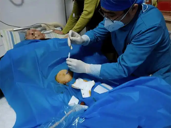 患者_尿道_导尿管