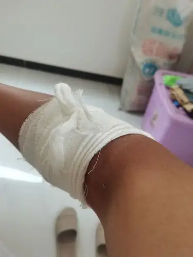 受伤了,休息会继续干活