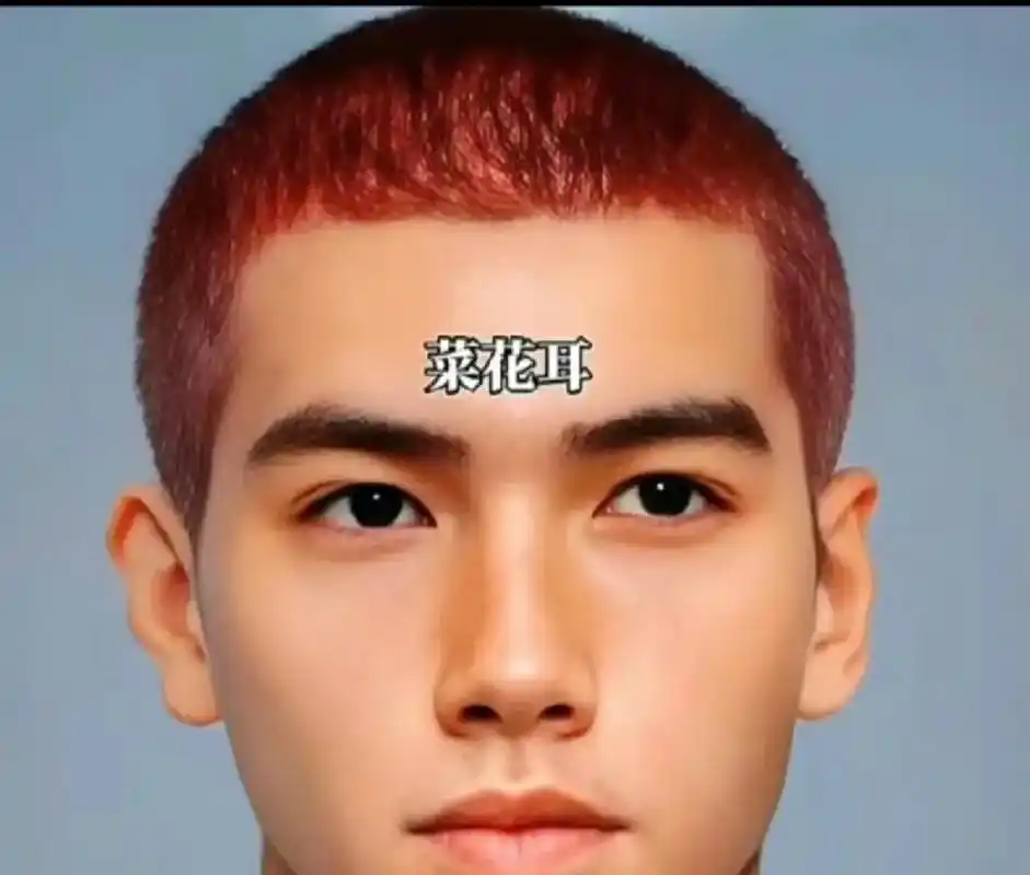 你是属于哪种耳型?#面相 #识人术 #相由心生 #脸型分析  - 抖音