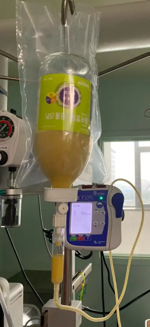 成人肠内营养支持的护理 - 学科动态 - 护理园地 - 阜外华中心血管病