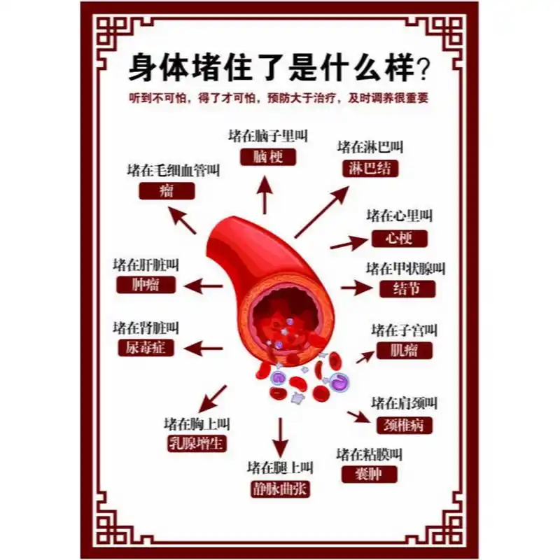 人到中年,最怕的就是血管堵塞,临床上常用到这