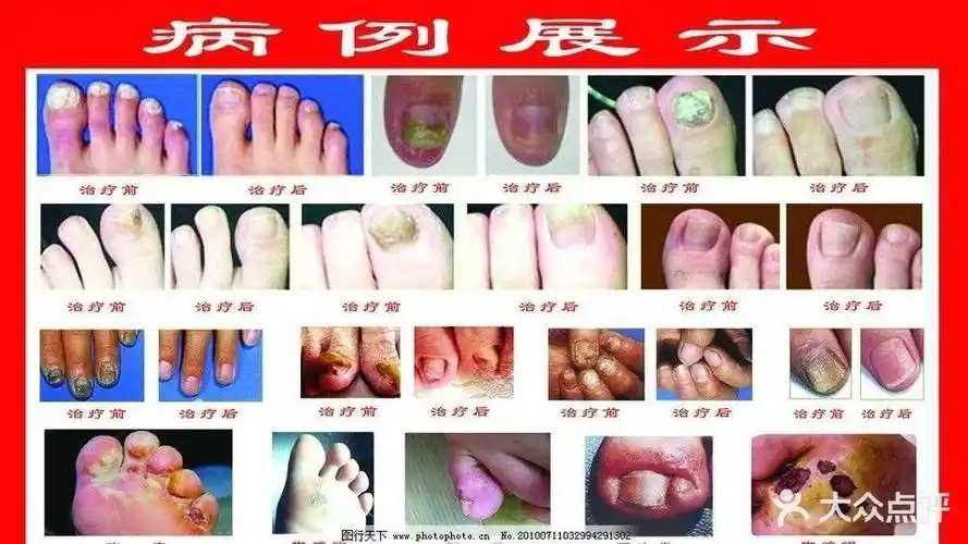 橡山捏脚铺子抚州分铺