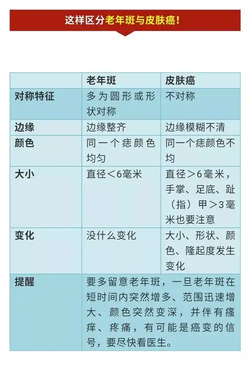 【健康】一张表格教你区分:老年斑与皮肤癌,食道癌与咽喉炎,前列腺炎
