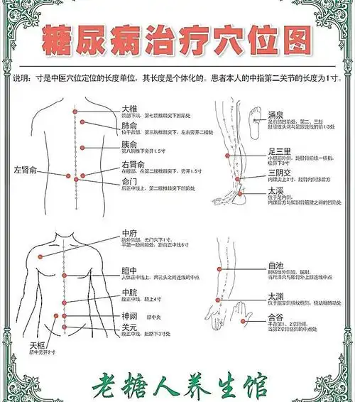 糖尿病治疗穴位图片平面广告素材免费下载(图片编号:3670496)-六图网