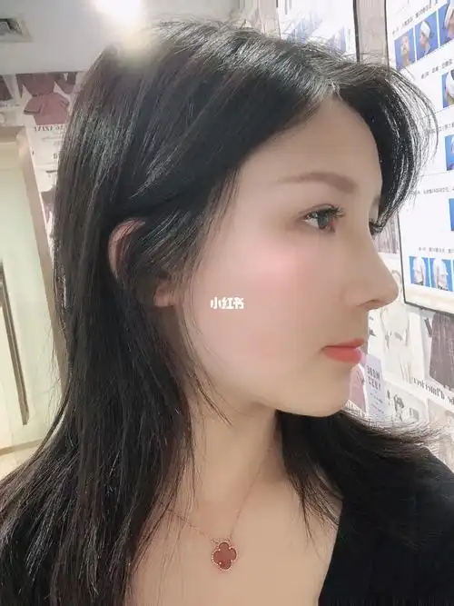 耳软骨鼻第10天