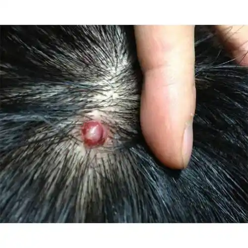 去屑止痒去螨虫洗发水?_黛熙_头皮屑_问题