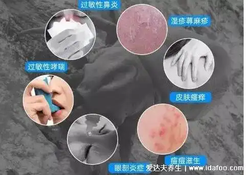 2,过敏性鼻炎或者哮喘被螨虫叮咬后是会出现皮肤的不适的,而且螨虫的