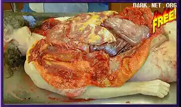 【贴图】部分医学解剖过程图片