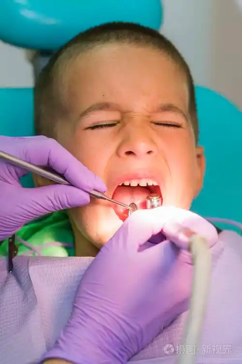 儿科牙医在牙科诊所的牙医椅子上检查一个小男孩的牙齿有牙医的孩子