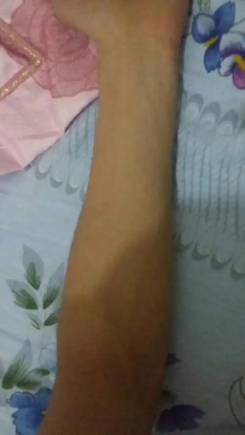 这样的手臂算粗吗