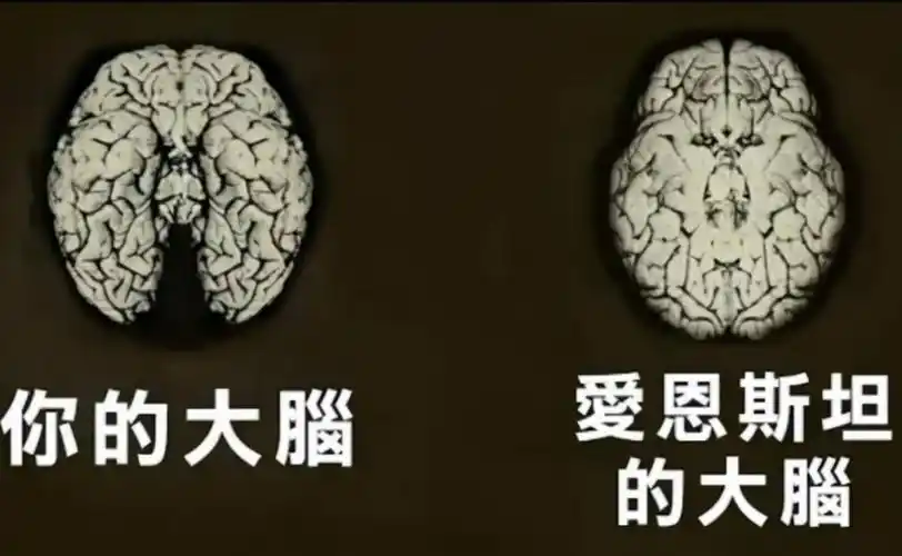 爱因斯坦的大脑有何特殊?研究发现:他的大脑多了73%的物质