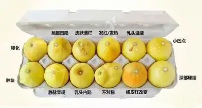②乳头分泌物主要是新陈代谢引起,废物堆积在乳头或乳孔中,使乳孔不