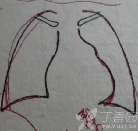 应进一步了解心内结构(包括心脏各房室大小),功能及血流情况,可行