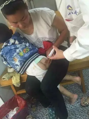 山海丹鱼金灌肠退热合剂经直肠给药治疗小儿外感发热