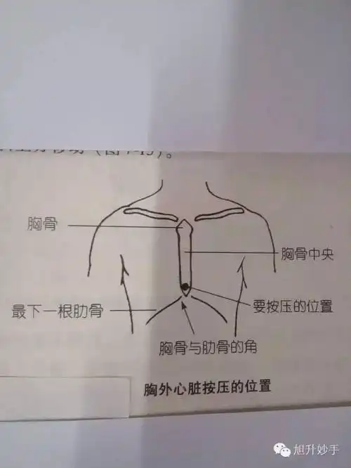 左手掌根置于病人胸骨的下半部,右手掌根压在左手背上,两手重叠或右手