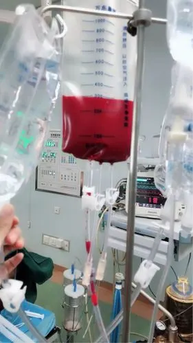 输血,还是自己的好.用自己的血,给自己做手术.