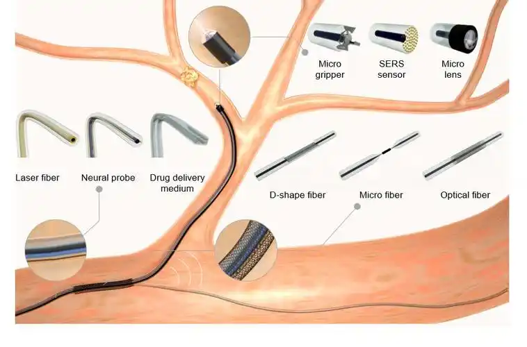 matter: 柔性纤维机器人激光手术刀的材料与制造挑战_澎湃号·湃客