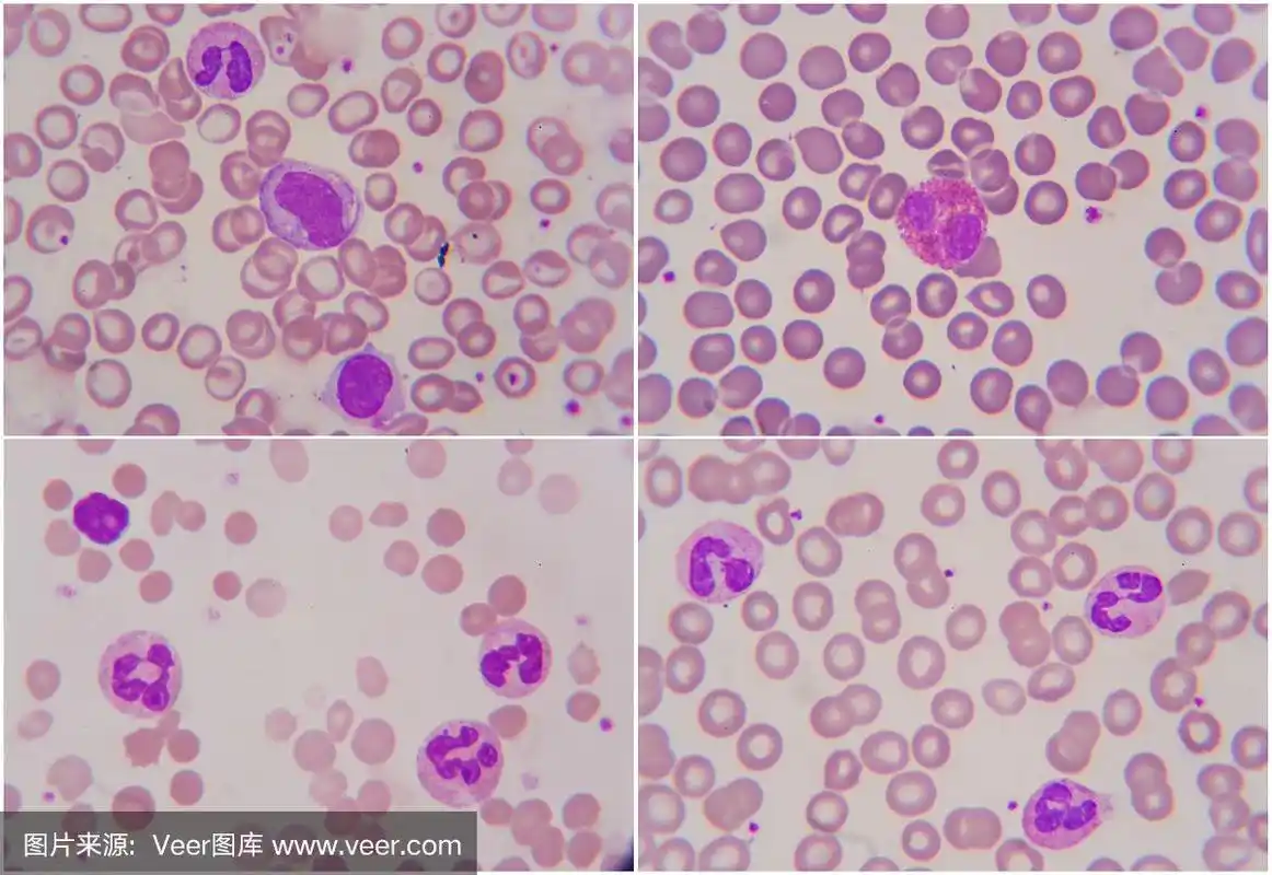 1000倍显微镜下的人体血细胞