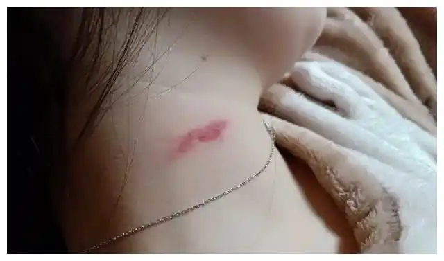 13岁女儿脖子上有"草莓印",父母追问原因,女儿的回答让人唏嘘