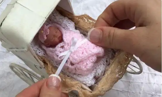 是在21周零6天就将她娶了起来,当时艾米莉亚的胚型几乎还没有真正成型