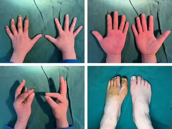 示指_手术室_患者