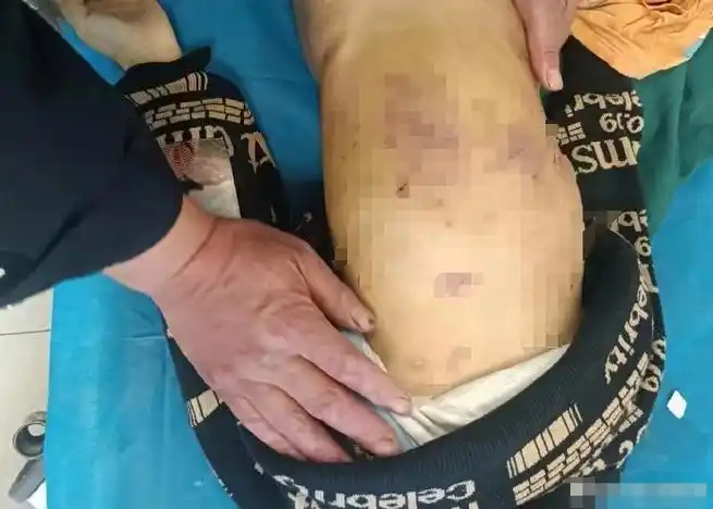 山东威海5岁男童疑似非正常死亡生母和同行男子送医照片曝光爷爷回应