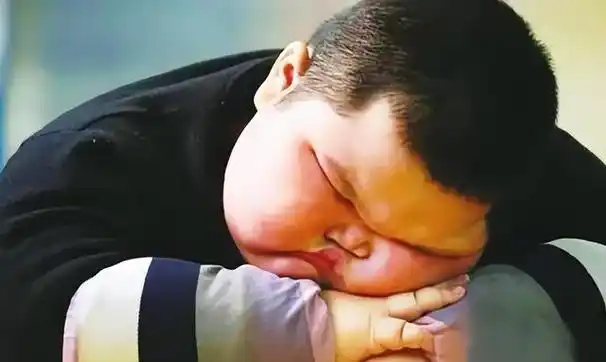 小曲妈妈感觉自己孩子的胃就像一个无底洞一样,怎么都喂不饱,可是检查