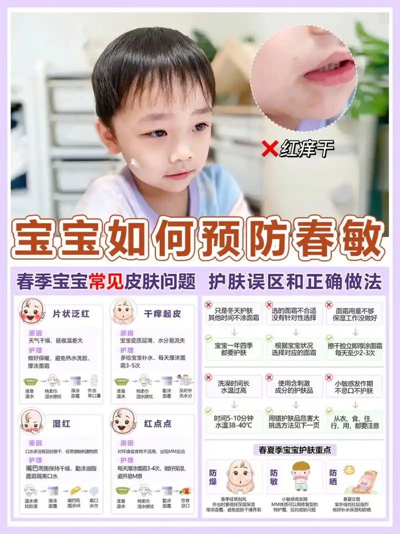 宝宝如何预防春敏.