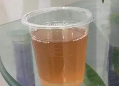 可能引起轻度血尿,尿色呈现类似西瓜汁或洗肉水的淡红色