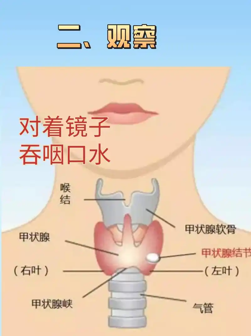 甲状腺结节自查-你的甲状腺还好吗?