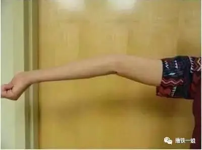 她的手肘,跟下图的状态很类似.