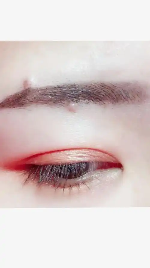 这是两颗白色痣哦,我挤给你们看,不是痘呦