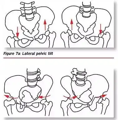 骨盆的生理运动包括前倾(后倾),上升(下降),旋转.