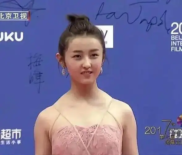 理涛,溜肩是不是很难改善?到底和什么有关?该怎么改善?